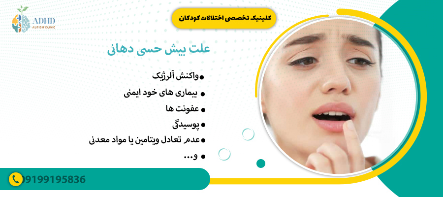علت بیش حسی دهانی